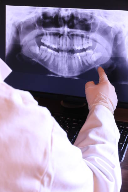 Best Emergency Tooth Extraction in Llano Grande, TX