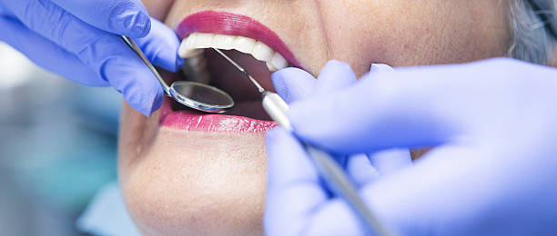 Best Emergency Dental Care for Broken or Chipped Teeth in Llano Grande, TX