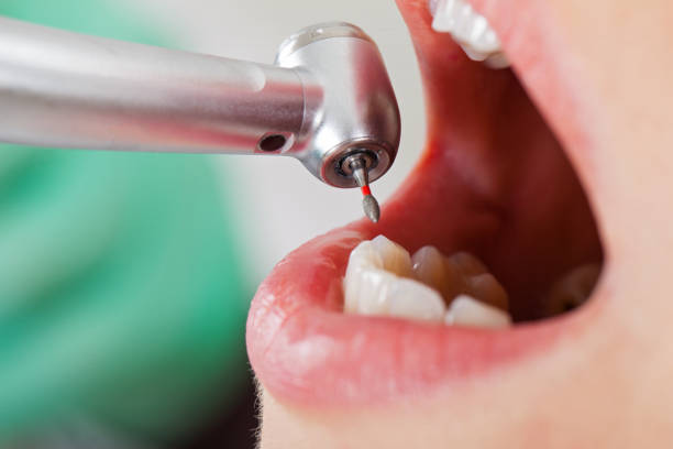 Best Emergency Denture Repair in Llano Grande, TX